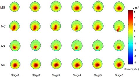 Eeg Alpha Wave Band Brain Topography Download Scientific Diagram