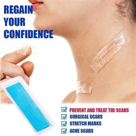 Buy Silicone Scar Removal Patch Reusable Acne Gel Scar Therapy Silicon Patch