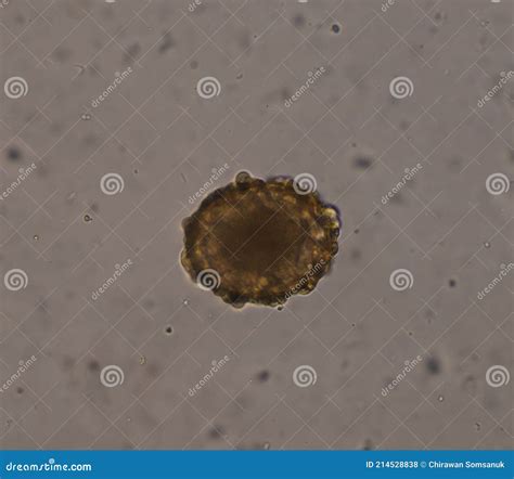 Ascaris Lumbricoides Egg In Stool Exam Stock Photo Image Of