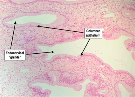 Cervix Histology Diagram