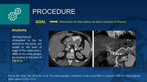 Plexus celiac neurolysis | PPT