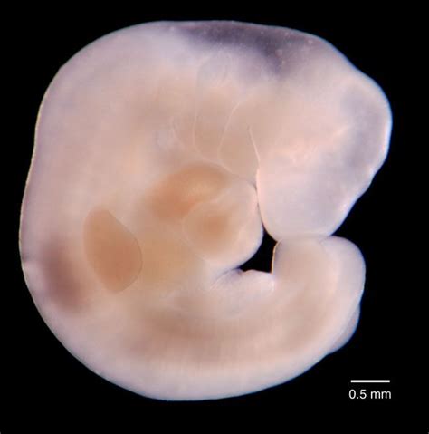 Medical School Human Embryo At Carnagie Stage 13 28 Days Most