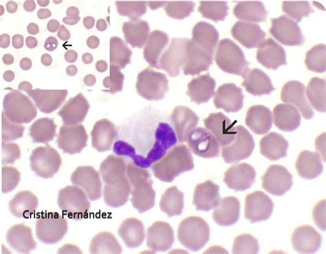 Endoparasitos Y Ectoparasitos En Equinos Parasitos Sanguineos