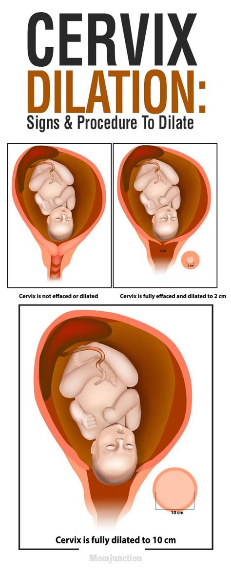 Diagram Of Cervix And Mucus Plug Cervix Cervical Mucus Conce