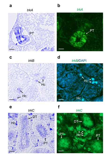 Chromogenic And Fluorescence In Situ Hybridization For Tyrosine Kinase