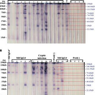 Representative Western Blot Results For Microfilaraemic Probe With