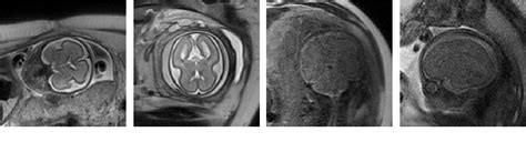 Figure From A Joint Brain Extraction And Image Quality Assessment