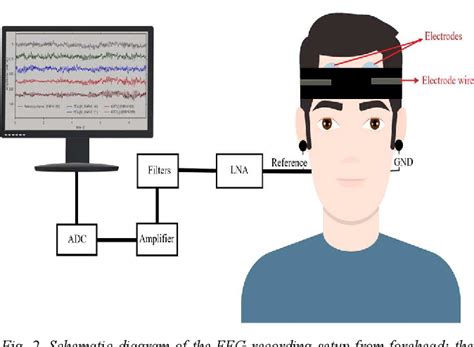 Figure 2 From Design And Fabrication Of Wearable And Stretchable Eeg