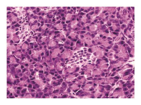 Photomicrographs Of Pancreas Sections In Each Group Normal Pancreatic