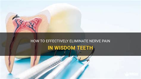 How To Effectively Eliminate Nerve Pain In Wisdom Teeth | MedShun