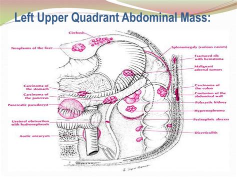 Left Upper Quadrant Anatomy