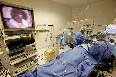 Cataract Surgery Stock Image M570 0168 Science Photo Library