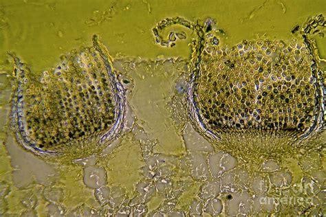 Rust Fungus In A Leaf Photograph by Dr Keith Wheeler/science Photo Library