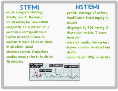 STEMI Vs NSTEM MEDizzy