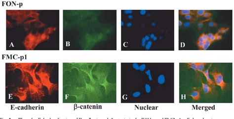 Figure From Expression And Subcellular Localization Of E Cadherin