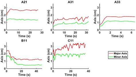 Visualizing Intratumoral Injections In Lung Tumors By Endobronchial