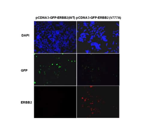 ERBB2 V777A NewEast Biosciences GTPase Oncogene And Bioactive Protein