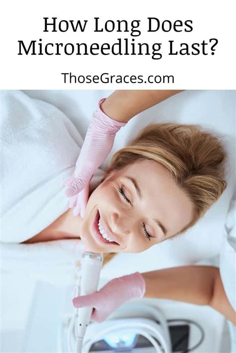 How Long Does Microneedling Last Unlock The Secrets ThoseGraces