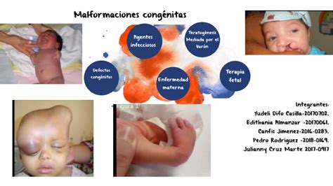 Malformaciones congénitas by edithania almanzar on Prezi