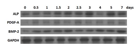 Altered Microrna Expression Profile In Exosomes During Osteogenic