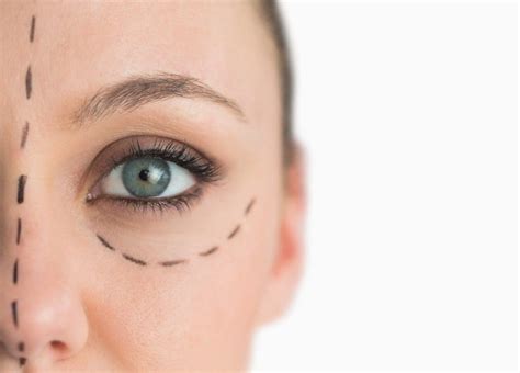 Blepharoplasty Recovery Time in Palm Beach, FL