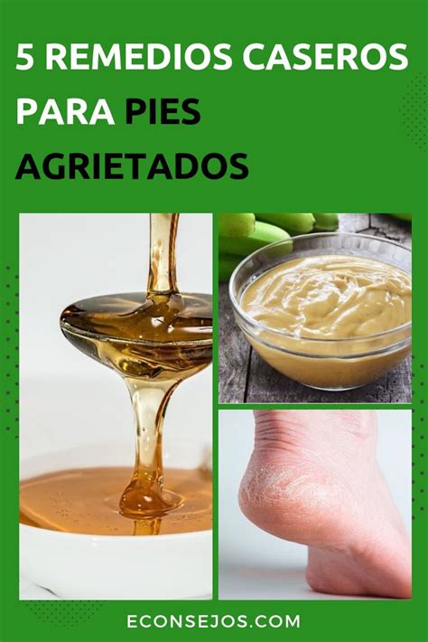 5 Remedios caseros para pies agrietados que los hidratarán Pies