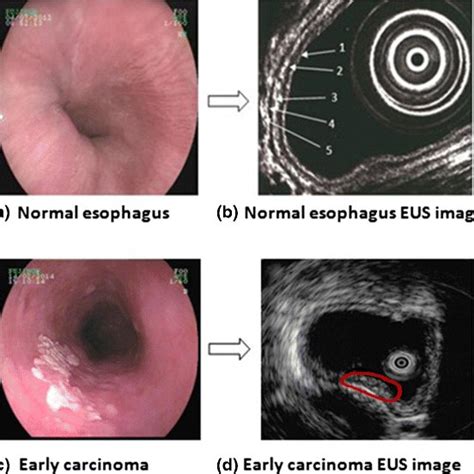 The Confusion Matrix For Eus Image Classification Download Scientific