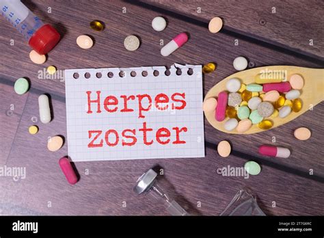 krankheit herpes zoster Fotos und Bildmaterial in hoher Auflösung