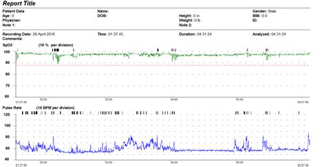 Overnight Oximetry Screening - HOMECARE MEDICAL