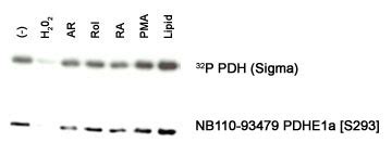 Anti Pdha Pdh E Alpha Antibody Rabbit Anti Human Polyclonal Lsbio