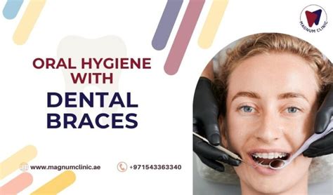 Maintaining Oral Hygiene With Dental Braces Tips And Best Practices