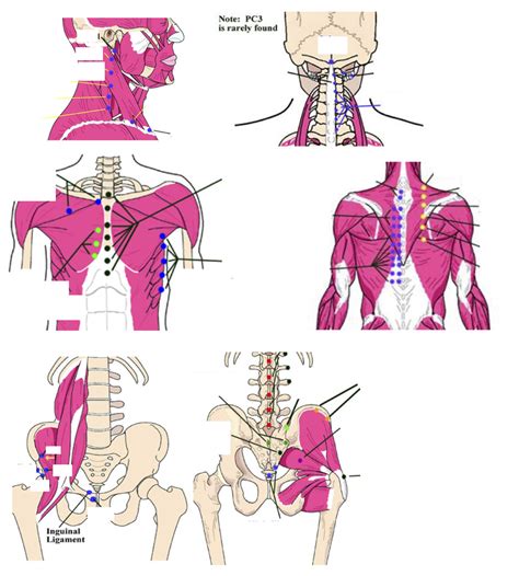 OMM514 Practical Counterstrain Points Diagram Quizlet