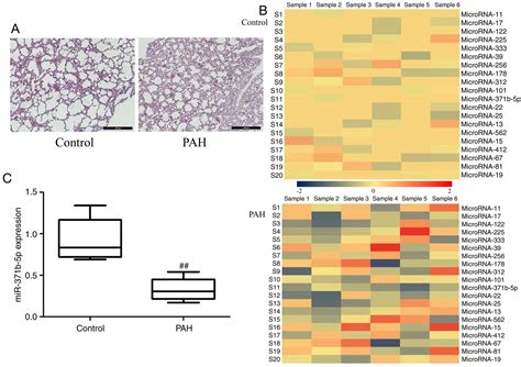 Mir‑371b‑5p Inhibits Endothelial Cell Apoptosis In Monocrotaline