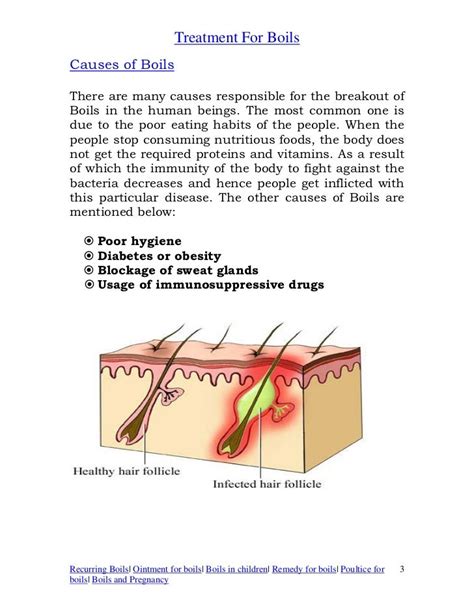 Treatment for boils