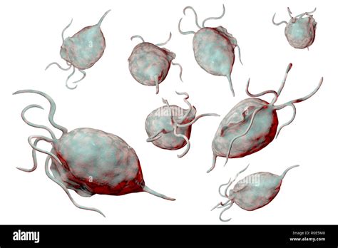 Trichomoniasis Vaginitis