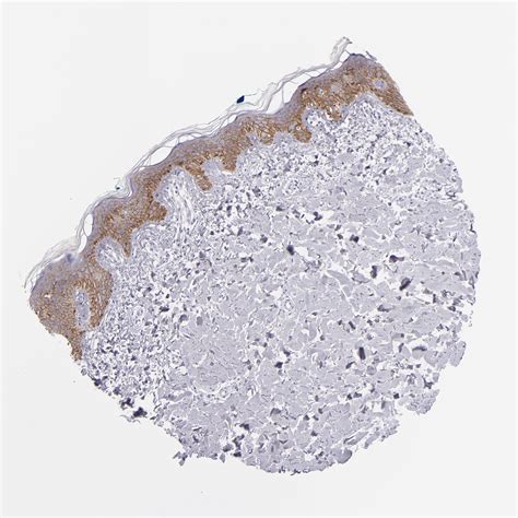 Tissue Expression Of Cdh Staining In Skin The Human Protein Atlas