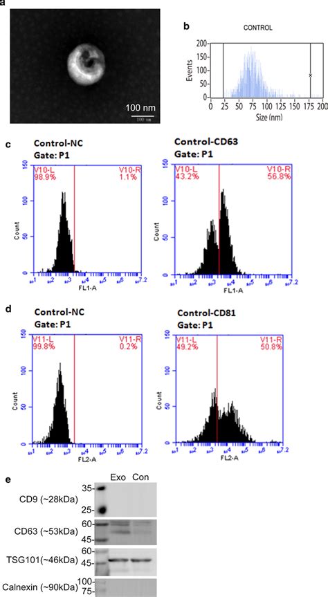 Characterization Of Hbmscs Derived Exosomes Transmission Electron