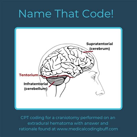 Icd 10 Cm Medical Coding Mnemonics Quiz Artofit