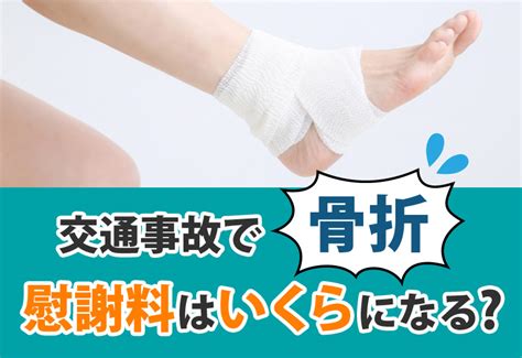 交通事故で骨折した時の慰謝料は？ 交通事故治療で整骨院へ通院なら事故したらcom