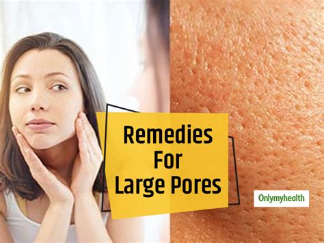 Skincare Home Remedies: Get Rid Of Large Pores On The Face With These ...