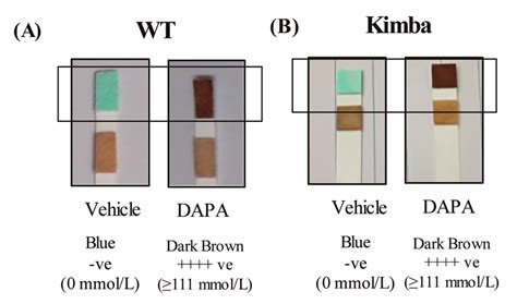 Sglt Inhibition With Dapa Promotes Glucosuria In Non Diabetic