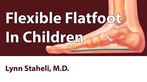 Flexible Flatfoot In Children Youtube