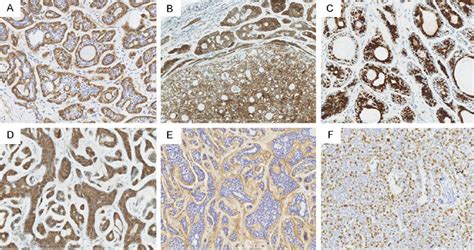 A F Immunohistochemistry A SMA Highlighted The Myoepithelial Cells