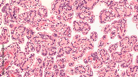 Photomicrograph Microscopic Photograph Showing Histology Of A Choroid