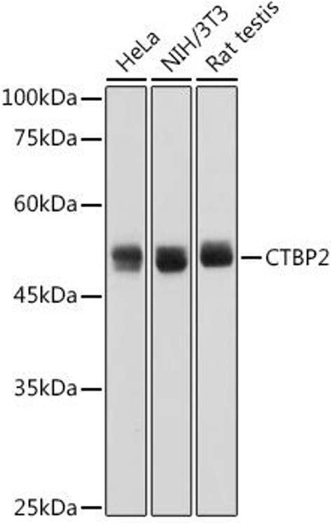 Anti Ctbp2 抗体 Assay Genie