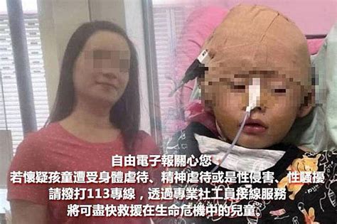 台中保母涉虐1歲童致腦傷 竟違法收托多達15幼兒 自由電子報 Line Today