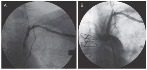 Angiography Of The Aorta And Peripheral Arteries Thoracic Key