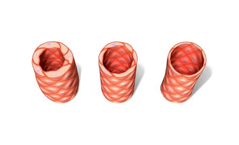 Blood Vessel Wall Anatomy By Henning Dalhoff Science Photo Library