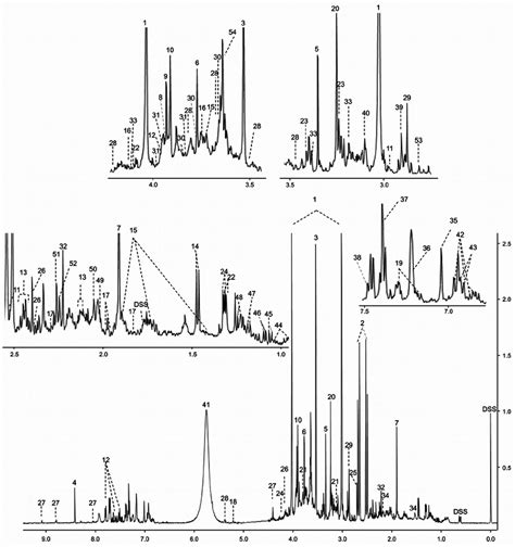 Typical 500 MHz 1 H NMR Spectra Of Urine From Human Urine Numbers