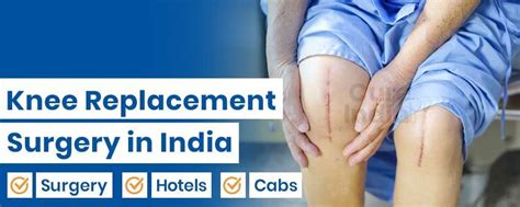 Total Knee Replacement Surgery In India Top Doctors Hospitals Cost